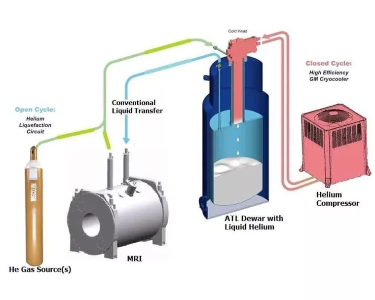 Heli lỏng trong máy MRI: Công dụng và chi phí sử dụng